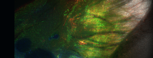 Revolutionizing Neuroscience